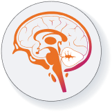 IONIS-MAPT (Alzheimer’s disease) clinical study